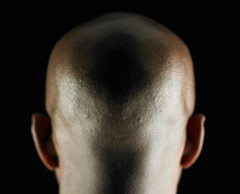 Base-BALD Deployer Bridges $12.9 Million To Ethereum, Moves 2,100 ETH To Kraken